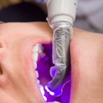 UV light male mouth iStock_000012251892XSmall (2)